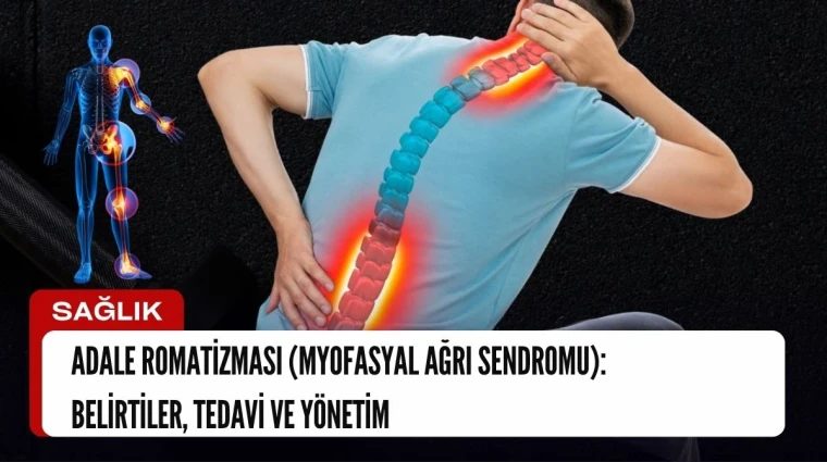 Adale Romatizması (Myofasyal Ağrı Sendromu): Belirtiler, Tedavi ve Yönetimleri nelerdir?